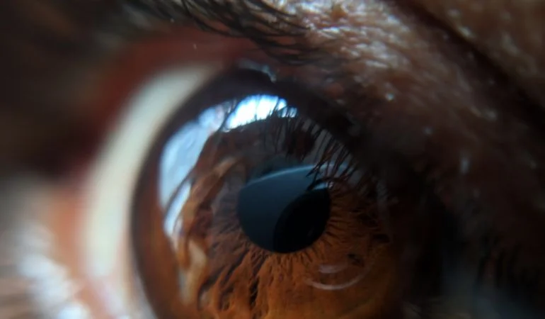 Eye Exercises for Squash Players: Enhance Performance and Prevent Strain