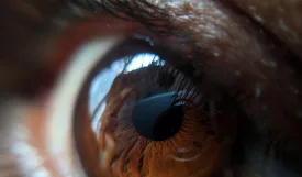 Eye Exercises for Squash Players: Enhance Performance and Prevent Strain